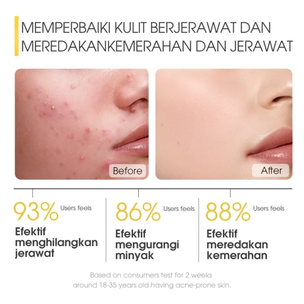 SKINEVER Asam Salisilat Perawatan Jerawat Masker Tidur Es dan Pembersih Scrub Menyegarkan Perawatan Jerawat Kontrol Minyak - Image 3