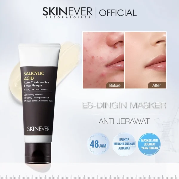 SKINEVER Salicylic Acid Acne Treatment Ice Sleep Masque Acne Soothes and Anti-Acne Skin Leave-on Masker Wajah Mud Mask Eksfoliasi